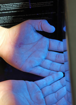 Unter Schwarzlicht wird deutlich, ob und wie gründlich die Hände desinfiziert worden sind. (Foto: OBK)